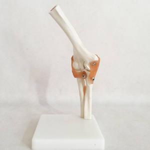 Life-Size Elbow Joint Medical Model